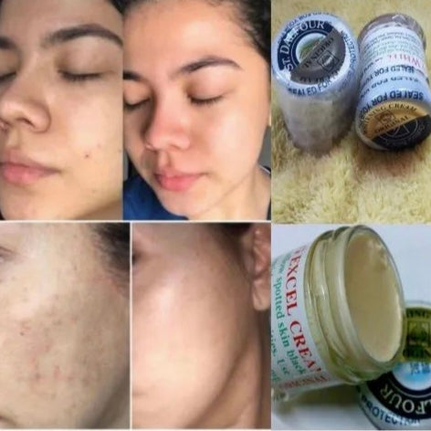 Collage of a woman applying cream to her face, close-up of her skin, and jars of cream on a textured surface.